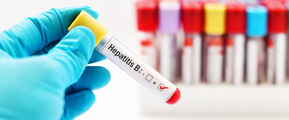 Što je hepatitis B? Koji su simptomi i metode liječenja?